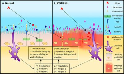 Manipulation of the Upper Respiratory Microbiota to Reduce Incidence and Severity of Upper Respiratory Viral Infections: A Literature Review